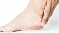 Ilustrasi kulit kaki alami pecah-pecah
