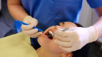 Ilustrasi root canal gigi