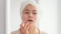 Ilustrasi eksfoliasi bibir